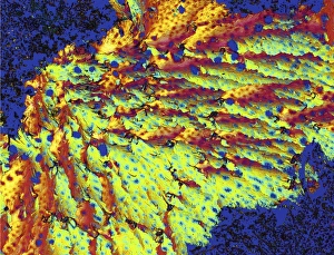 Progesterone hormone Print, Polarised light micrograph of crystals