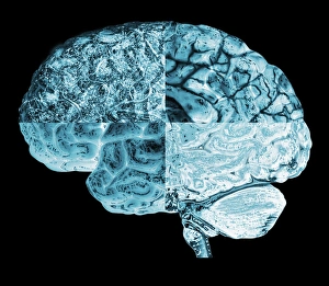 Neurology Images Prints: Quartered brain