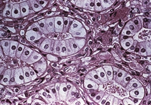 Renal collecting tubules Renal collecting tubules
