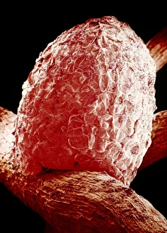 Root nodule of white clover plant Root nodule of white clover plant