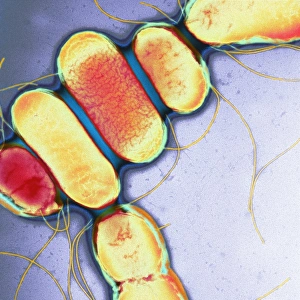 Salmonella, TEM Salmonella, TEM