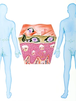 Images Dated 29th March 2001: Scabies Mite Infestation Print