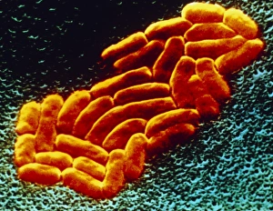 SEM of a colony of Klebsiella pneumonia SEM of a colony of Klebsiella pneumonia