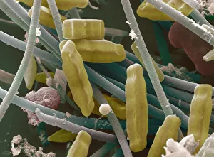 SEM of diatoms and blue-green algae SEM of diatoms and blue-green algae