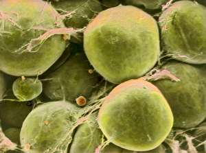Images Dated 1996: Coloured SEM Print of Adipose Tissue