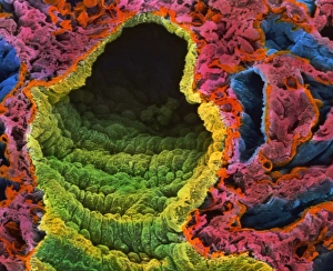 SEM of lung alveoli SEM of lung alveoli