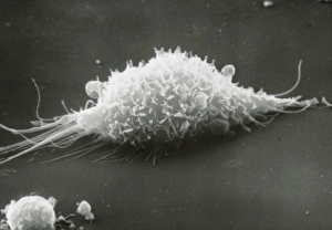Immune System Cells Prints: SEM of a macrophage cell moving over a surface