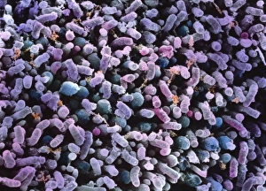 SEM of rod & cone cell of the retina SEM of rod & cone cell of the retina