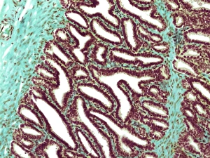 Male Reproductive System Prints: Seminal vesicle, light micrograph
