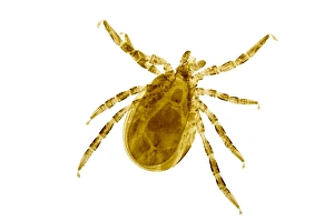 Light Micrograph Prints: Sheep tick, light micrograph
