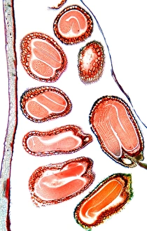 Embryo Development Stages Prints: Shepherds purse seeds, light micrograph