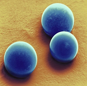 Silica microspheres, SEM Silica microspheres, SEM