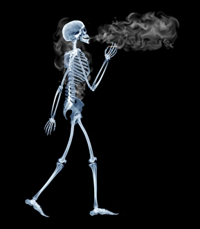 Prints of Skeleton. Computer-enhanced X-ray of a side view of a skeleton smoking a cigarette whilst walking Images Dated 2005 March: Computer-enhanced X-ray Print of a Skeleton Smoking