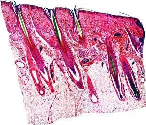Epidermis And Dermis Layers Prints: Skin section, light micrograph
