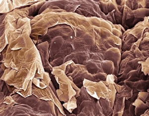 Images Dated 23rd May 2008: Coloured SEM Skin Print at x350 Magnification