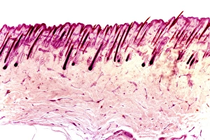 Prints of Skin tissue. Light micrograph of a transverse section through human skin. The skin is made up of an outer epidermis (pale purple, across top) with hair follicles (deep purple) Images Dated 2008 November: Human skin tissue print, x14 magnification