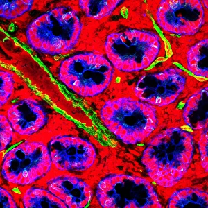 Prints of Small intestine. Fluorescence confocal light micrograph of a horizontal section through the mucosa of the human small intestine, showing crypts of Lieberkuhn (pink and blue) Images Dated 2006 June: Small Intestine Print: Fluorescence Confocal Micrograph