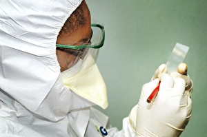 Viral Infection Prints: Smallpox infection