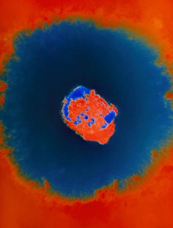 Smallpox Virus Prints: Smallpox virus