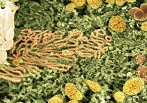 Scanning Electron Microscopy Images Prints: Smooth endoplasmic reticulum, SEM