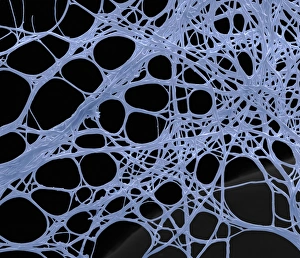 Scanning Electron Microscopy Photos Prints: Spider silk, SEM