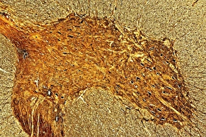 Spinal cord print, light micrograph of grey and white matter