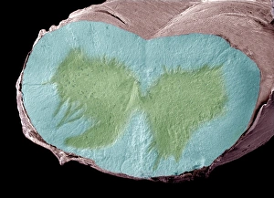 Myelinated Nerve Fibres Prints: Spinal cord, SEM