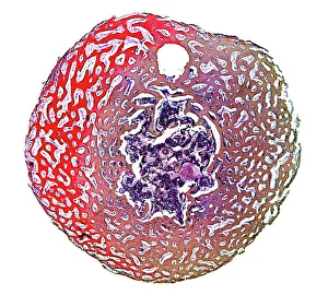 Prints of Spongy bone. Light micrograph of a section through stained and decalcified human spongy bone. This bone type is also called cancellous bone Images Dated 2008 November: Spongy Bone Print