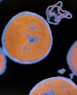 Staphylococcus aureus bacteria Staphylococcus aureus bacteria