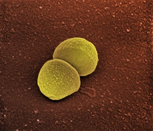 Staphylococcus Aureus Bacteria Prints: Staphylococcus aureus bacteria, SEM C013 / 4770