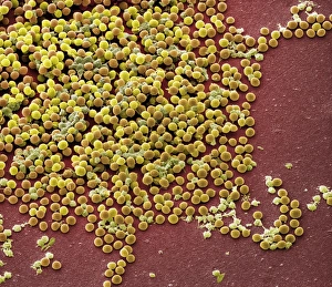 Staphylococcus Aureus Bacteria Prints: Staphylococcus aureus bacteria, SEM C017 / 7136