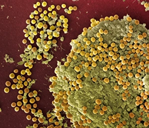 Scanning Electron Microscope Photos Prints: Staphylococcus aureus bacteria, SEM C017 / 7137