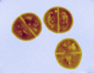 Staphylococcus Aureus Bacteria Prints: Staphylococcus aureus bacteria, TEM C016 / 9456