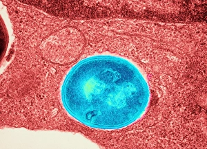 Staphylococcus Aureus Bacteria Prints: Staphylococcus aureus bacteria, TEM C016 / 9457