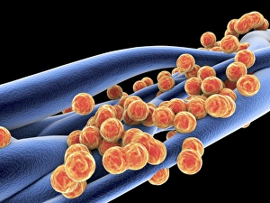 MRSA Bacteria Prints: Staphylococcus aureus MRSA bacteria