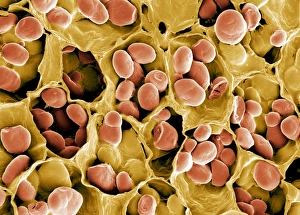 Prints of Starch grains. Coloured scanning electron micrograph (SEM) of starch grains (orange) in a black-eyed pea (Vigna sp.) Images Dated 2005 December: SEM Print of Starch Grains in Black-Eyed Pea