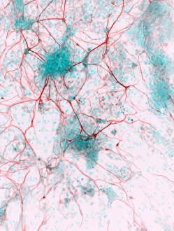 Prints of Stem cell-derived neurons. Light micrograph of human nerve cells (neurons) that have been derived from induced pluripotent stem cells (IPS). Tuj1 proteins are cyan, and cell nuclei are red Images Dated 2012 December: Stem Cell-Derived Neurons Print
