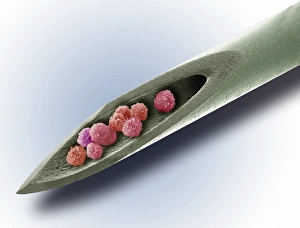 Coloured Scanning Electron Micrograph Prints: Stem cell therapy, conceptual image