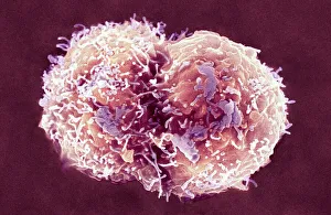 Prints of Stem cells, coloured scanning electron micrograph (SEM). Stem cells can differentiate into any other cell type Images Dated 2008 February: Coloured SEM Print of Stem Cells