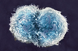 SEM Print of Differentiating Blood Cells
