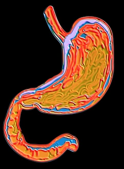 Human Body Organs Prints: Stomach