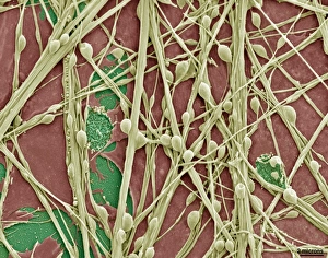 Synapse Nerve Junctions Print, Coloured SEM Image