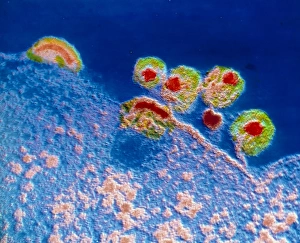 Human Immunodeficiency Virus Prints: TEM of Aids virus