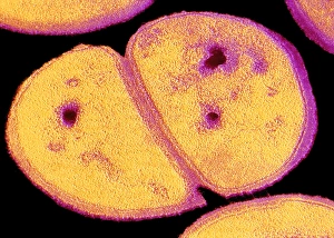 Transmission Electron Microscopy Images Prints: TEM of dividing staphylococcus aureus