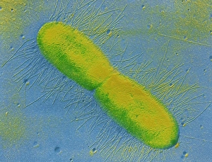 Escherichia Coli Micrograph Prints: TEM of E. coli bacterium