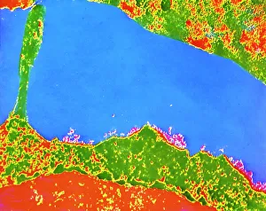 TEM of human white blood cell bearing HLA antigen TEM of human white blood cell bearing HLA antigen