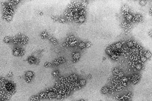 TEM of influenza vaccine of haemagglutinin TEM of influenza vaccine of haemagglutinin