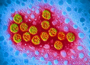 RNA Virus Structure Prints: TEM of rotavirus particles