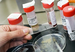 Lung Disease Diagnosis Prints: Testing sputum for lung diseases