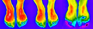 Thermogram of feet Thermogram of feet